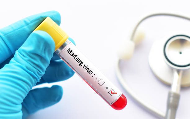 Rwanda: The Ministry of Health Emphasises that the Marburg Virus has not spread throughout the country